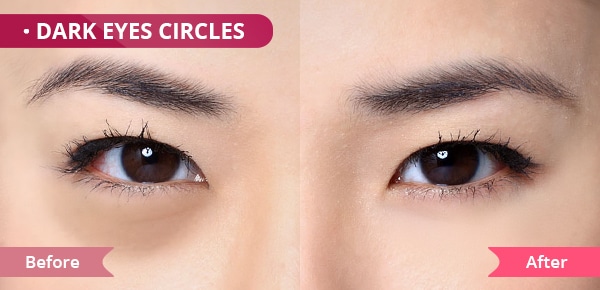 eye cream for Dark Eye Circles