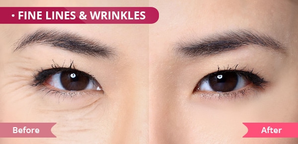 eye cream for Finelines and Wrinkles