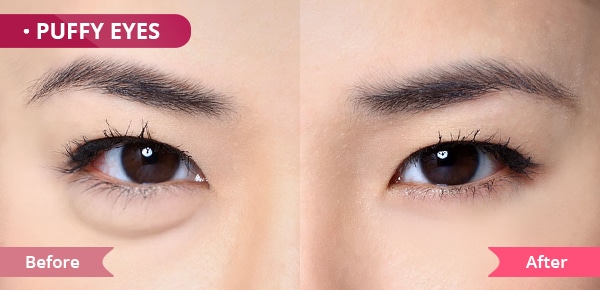 eye cream for Puffy eyes