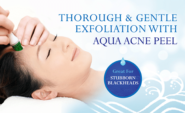 acne treatment singapore - aqua acne peel