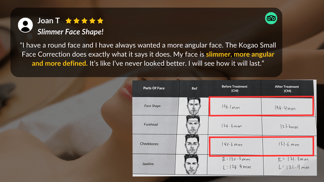 A testimonial showcases the effectiveness of a face slimming treatment, including small face correction, with before and after measurements for face shape, forehead, cheekbones, and jawline.
