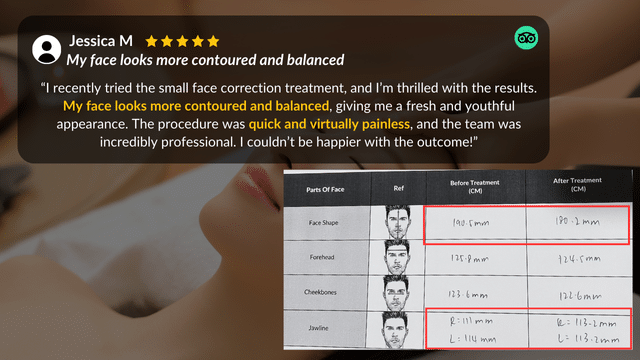 Review and chart highlighting changes in face shape, forehead, cheekbones, and jawline measurements after a Small Face Correction cosmetic treatment.