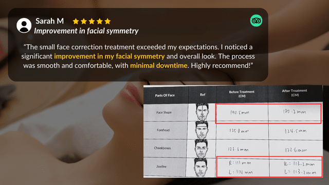 Review highlighting facial symmetry improvement and small face correction, with measurements before and after treatment shown in a chart.