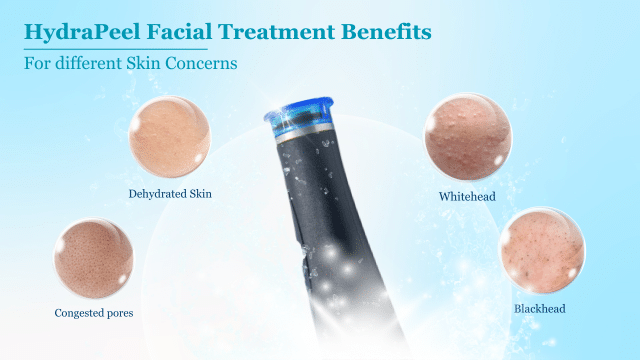 Get ready to unleash the magic of a HydraFacial Peel treatment and indulge in its remarkable benefits. This revolutionary skincare solution combines the power of water-based exfoliation with nourishing ingredients to leave your skin soft and clear.