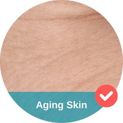Close-up view of aging skin with visible fine lines and texture, labeled "Aging Skin" with a check mark icon. Consider a hydrafacial for refreshed, youthful radiance.