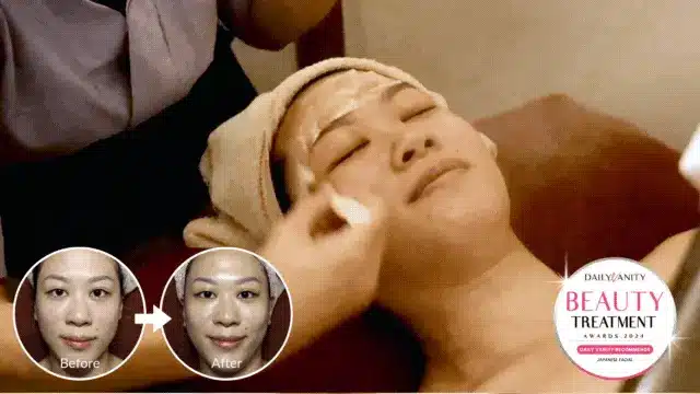 A person lies on a treatment bed with a towel on their head during a paradeoflove facial treatment; before and after inset images show visible skin improvement.