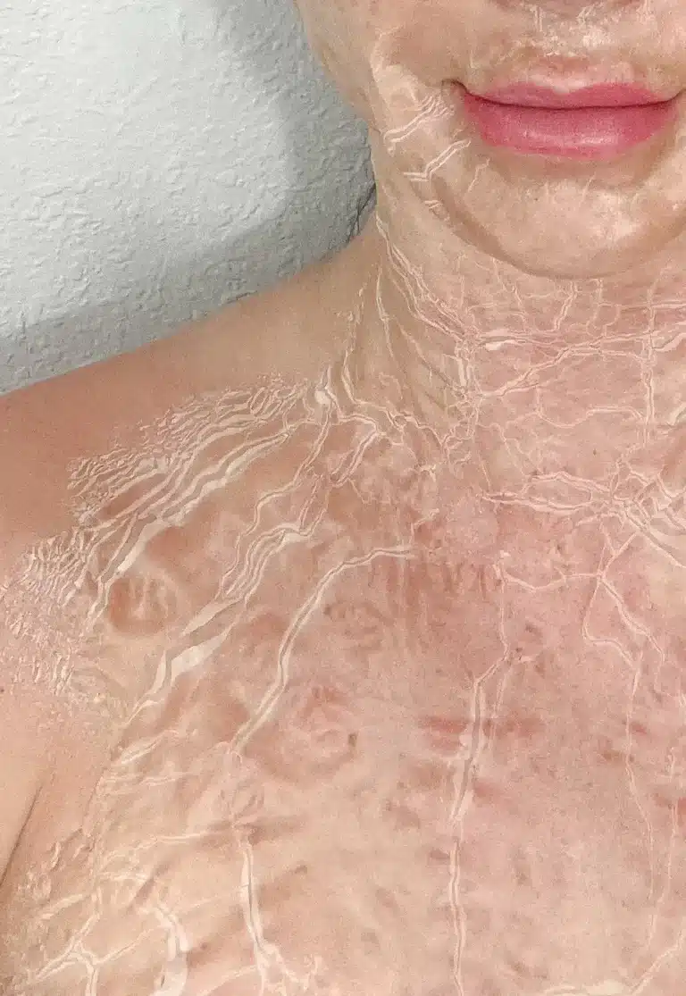 Close-up of a person’s lower face, neck, and chest with dried, peeling facial mask or skin treatment visible on the surface.