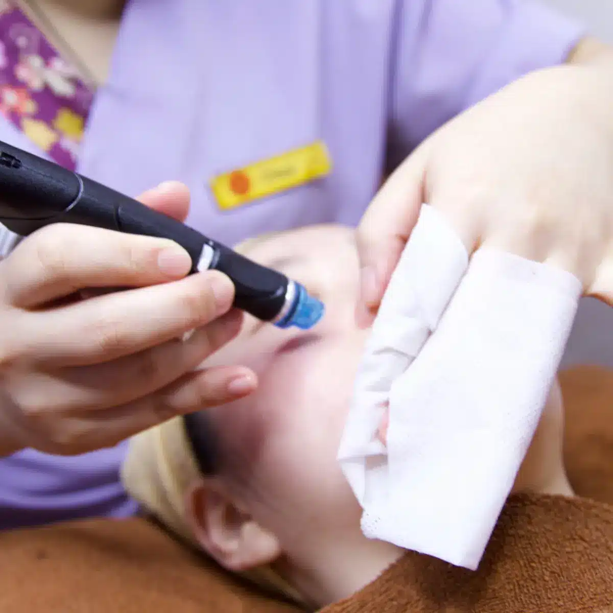 A person with acne is receiving a facial treatment using a handheld device while an attendant holds a tissue near their face.