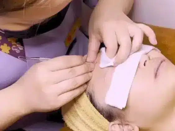 A person lies on a spa bed with a towel round their head and eyes covered while a beautician uses tweezers to work on their eyebrow, providing gentle care for both brows and acne-prone skin.