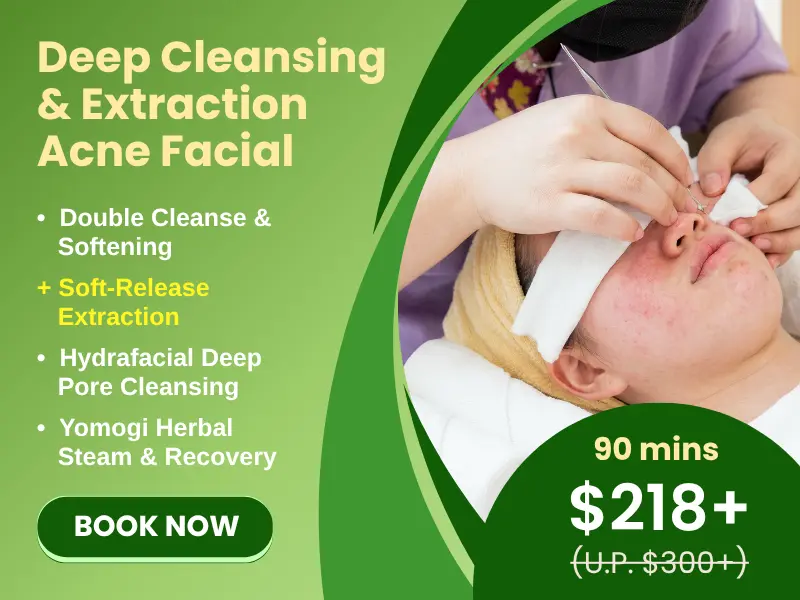 A person receiving an acne facial; text highlights features like deep cleansing, targeted extraction, a 90-minute session, and a special price reduction from $300 to $218+.