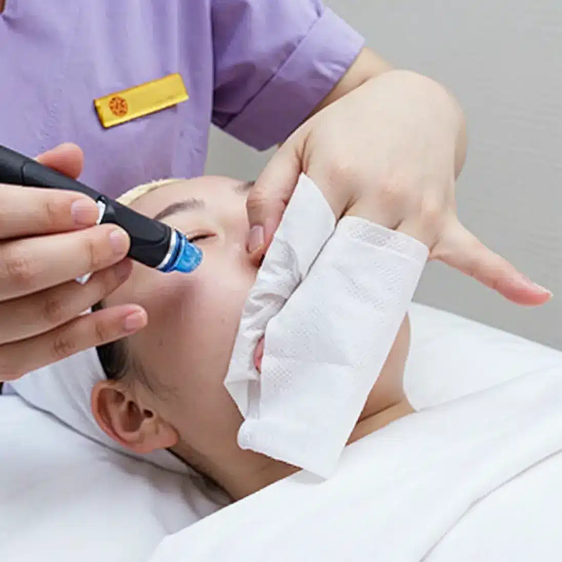 A person receives an acne facial treatment with a handheld device whilst holding a tissue to their face, lying comfortably on a treatment couch.